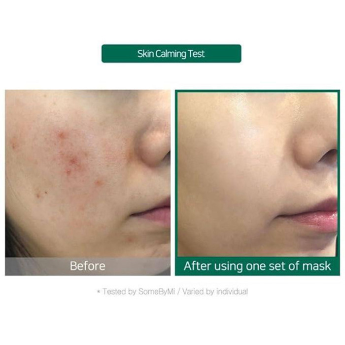 [SOME BY MI] TEA TREE CALMING GLOW LUMINOUS AMPOULE MASK