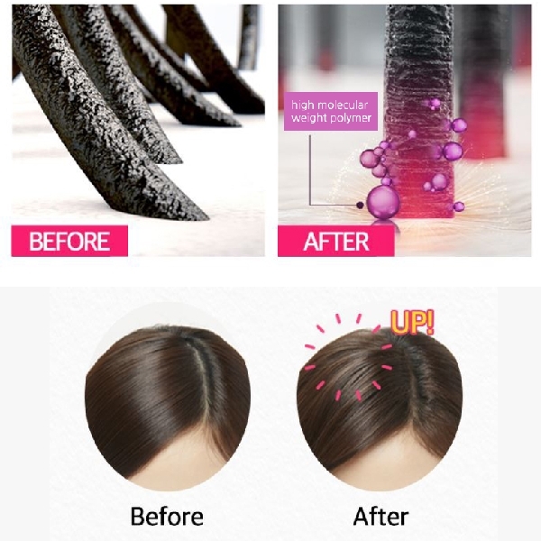 RYO Hair Loss Expert Care