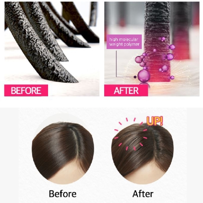 RYO Hair Loss Expert Care