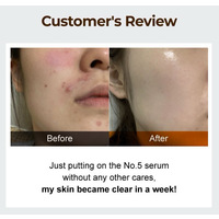 Numbuzin No.5 Good Bye Blemish Serum