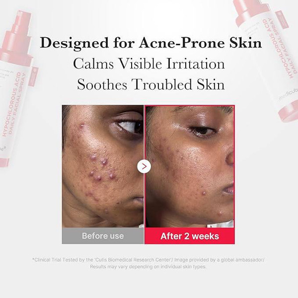 [medicube] HYPOCHLOROUS ACID DAILY FACIAL SPRAY